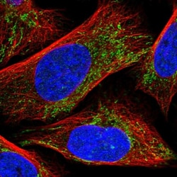 CLPX Antibody, Novus Biologicals 0.1mL; Unlabeled:Antibodies, Polyclonal